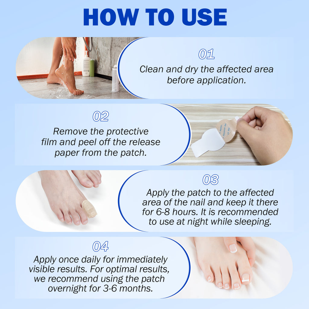 Elaimei Nail Antibacterial Patch, Nail Protection, Nail Enhancement, Onychomycosis, Bright Nail, Nail Antibacterial Patch 21P